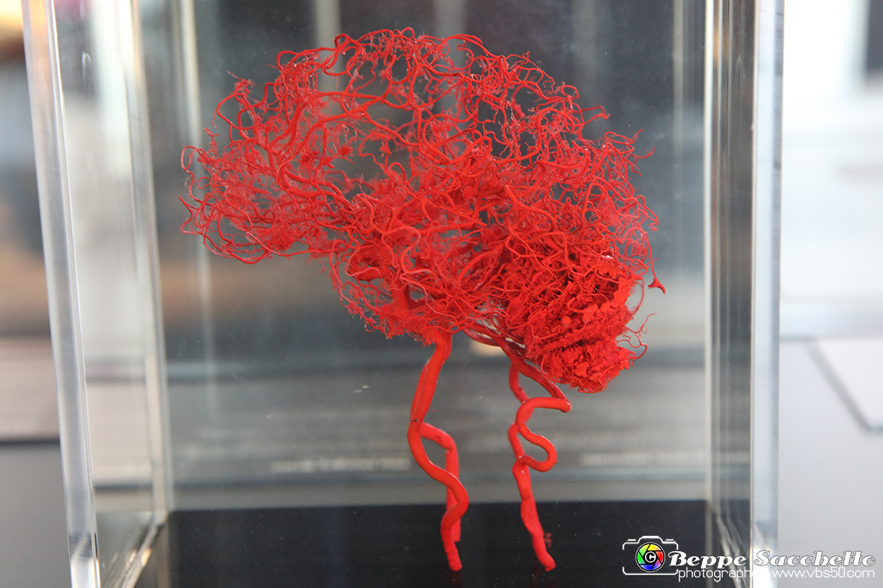 VBS_3010 - Arterie del cervello - Mostra Body Worlds.jpg
